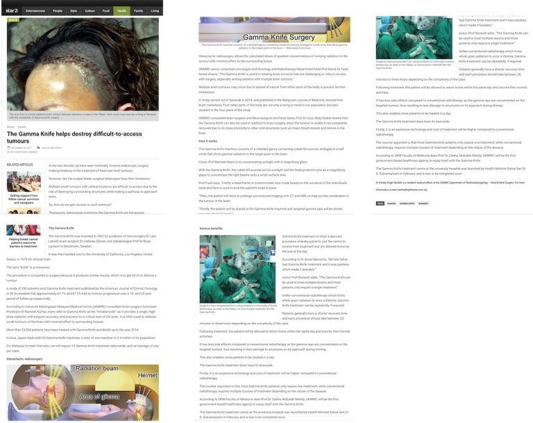 Gamma Knife Radiosurgery: A Safe and Effective Treatment for Brain Metastases in Pregnancy